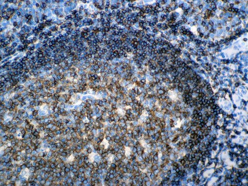 IHC of CD45R on an FFPE Tonsil Tissue